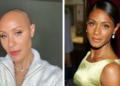 Jada Pinkett Smith Hair Loss