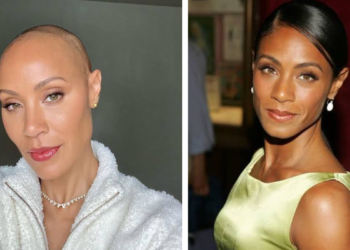 Jada Pinkett Smith Hair Loss