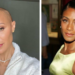 Jada Pinkett Smith Hair Loss