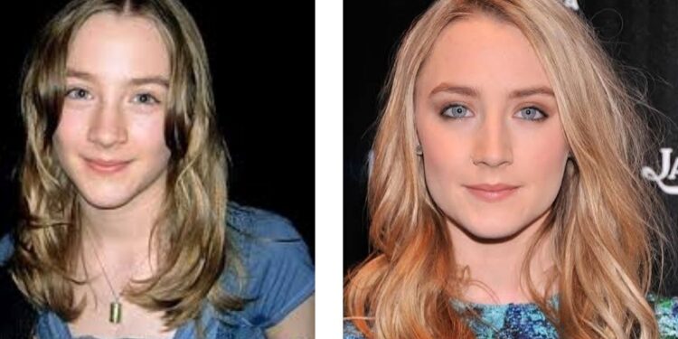 10 Amazing Facts About Saoirse Ronan: The Journey of a Global Icon