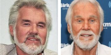 10 Ultimate Facts About Kenny Rogers: Unveiling the Phenomenal Musical Journey, Country Anthems, and Cultural Impact of a Legend