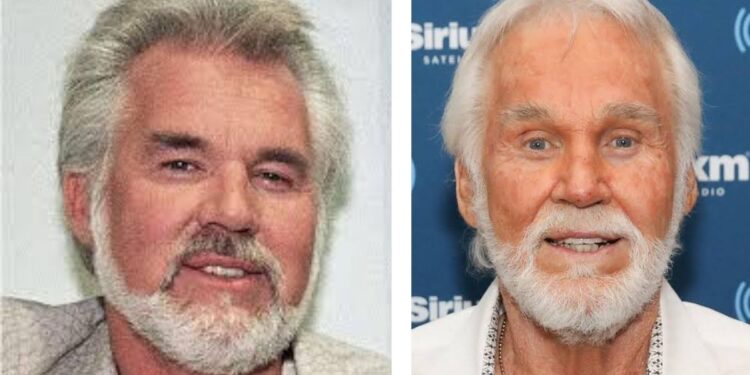 10 Ultimate Facts About Kenny Rogers: Unveiling the Phenomenal Musical Journey, Country Anthems, and Cultural Impact of a Legend