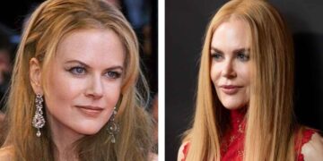 16 Incredible Facts About Nicole Kidman and Her Legendary Career